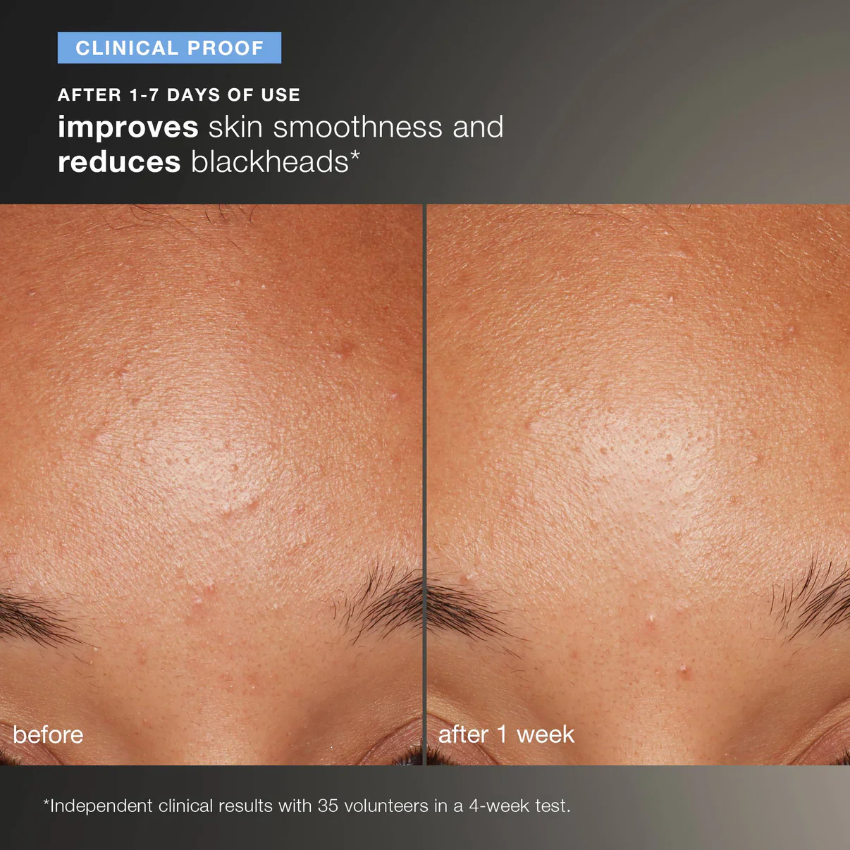 daily microfoliant exfoliator travel size - Image 4