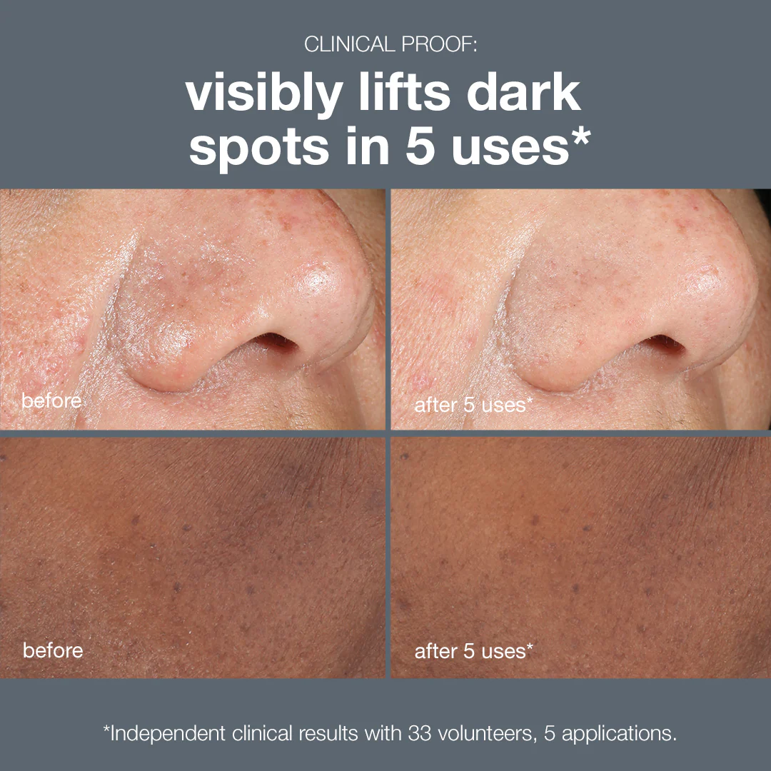 powerbright dark spot peel - Image 4